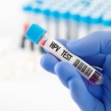 5 Things You Should Know About HPV